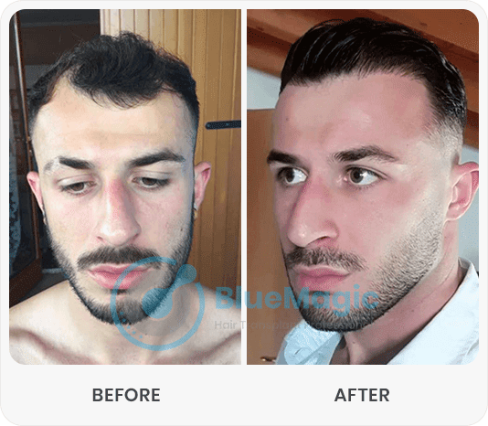 After-Before