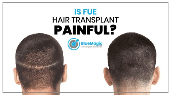 Is FUE Hair Transplant Painful? - Bluemagic Clinic