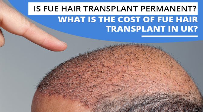 What to Expect After FUE Hair Transplant | Blue Magic