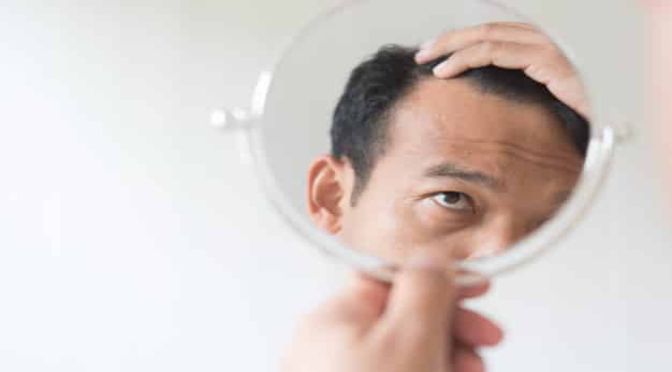 Signs Of Thinning Hair Hair Fall Problems For Mens