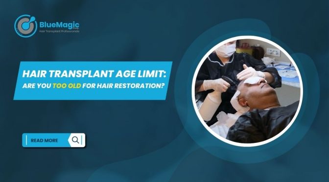 Hair Transplant Age Limit: Are You Too Old For Hair Restoration?