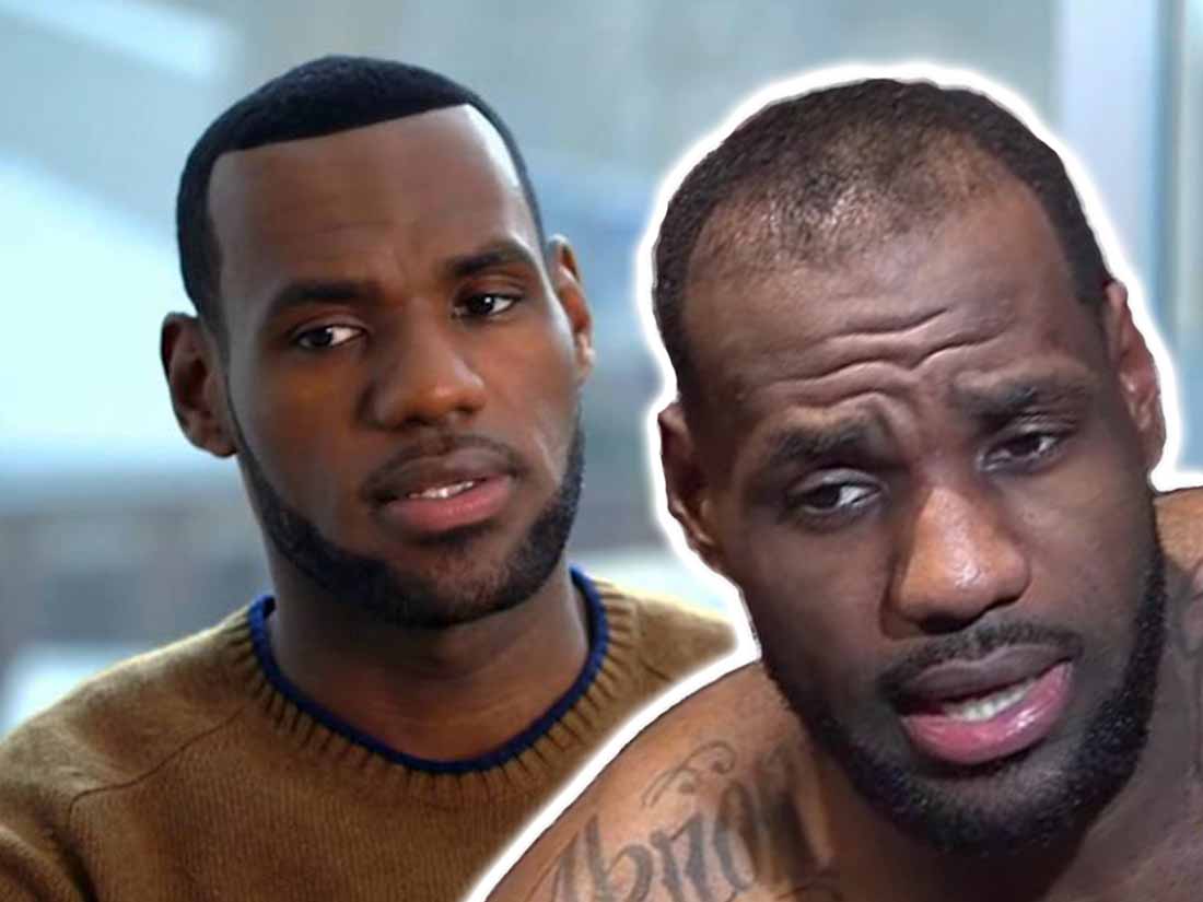 The Journey of LeBron James' Hair Transplant BlueMagic Group