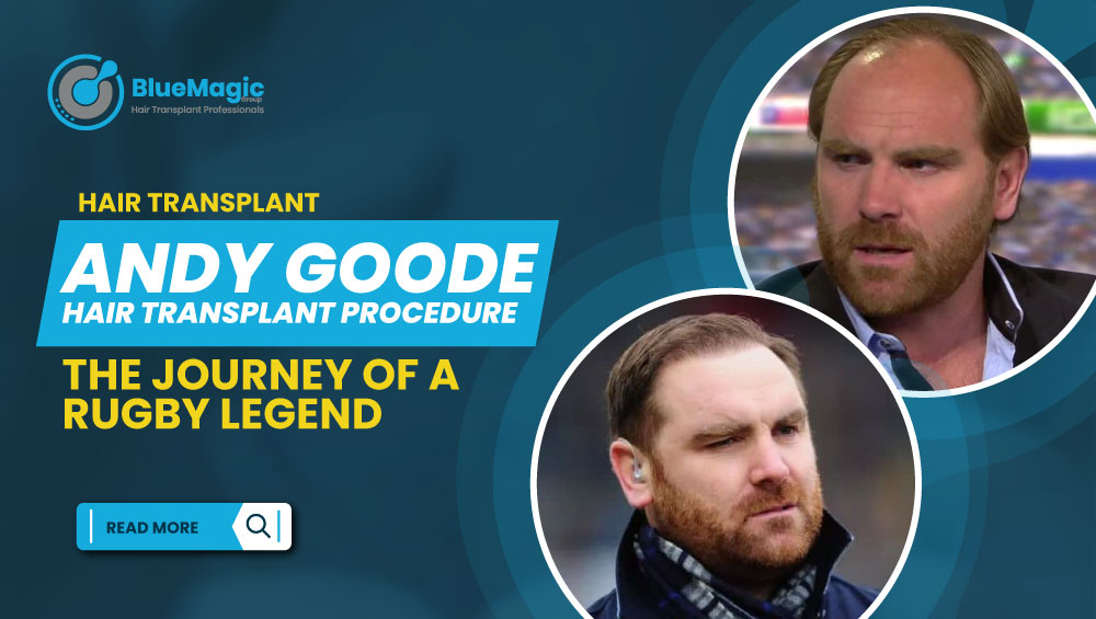 Andy Goode Hair Transplant - BlueMagic Group Clinic