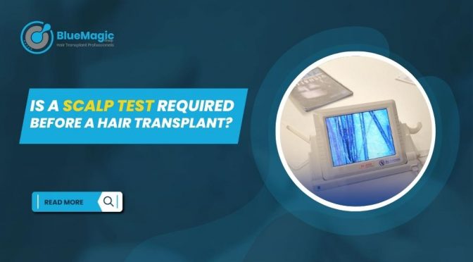 Is a Scalp Test Required Before a Hair Transplant?