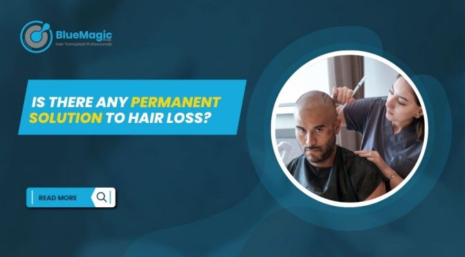 Is There Any Permanent Solution to Hair Loss?