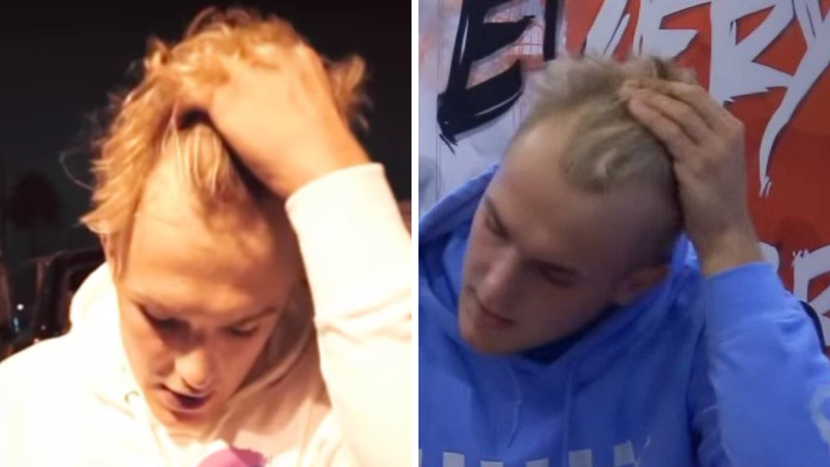 Jake Paul Hairline - bluemagic group turkey