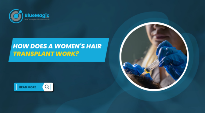 Women's Hair Transplant